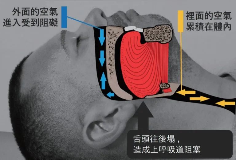 通過(guò)這樣訓(xùn)練就能改善睡覺(jué)打呼嚕（轉(zhuǎn)給需要的...）